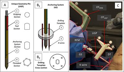 Design and Evaluation of a Percutaneous Fragment Manipulation Device for Minimally Invasive Fracture Surgery